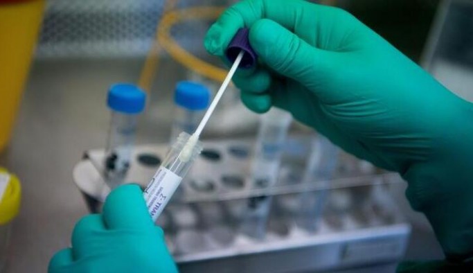 PCR testlerinin fiyatı düşürüldü