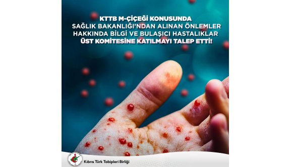 Tabipler Birliği, M-Çiçeği konusunda Bulaşıcı Hastalıklar Üst Komitesi’ne katılmayı talep etti