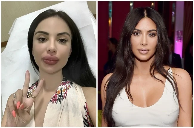 Kim Kardashian'a benzemek için anne olamayacak