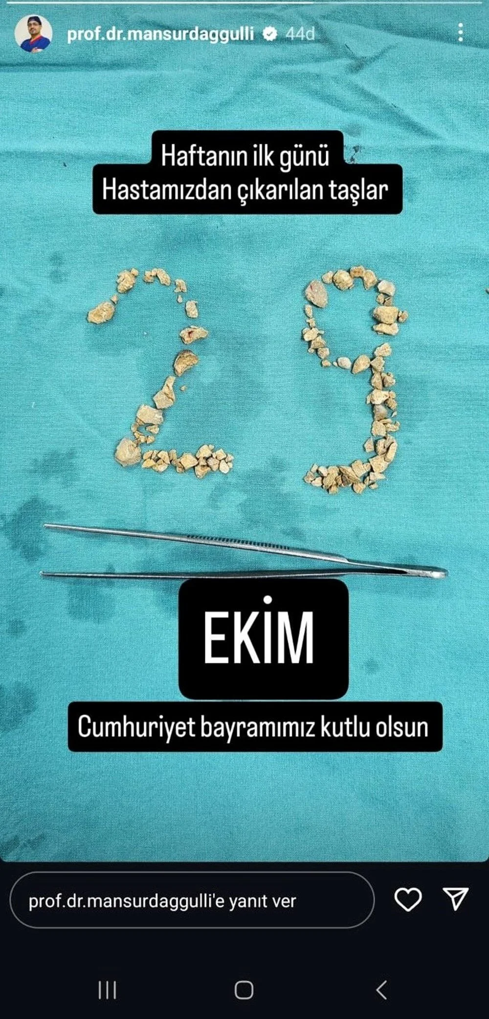 Böbrek taşlarıyla 29 Ekim kutlaması